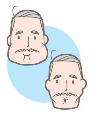 嚥下体操のうち、両頬を膨らませたりすぼめたりする準備運動で口の周りの体操を示した図